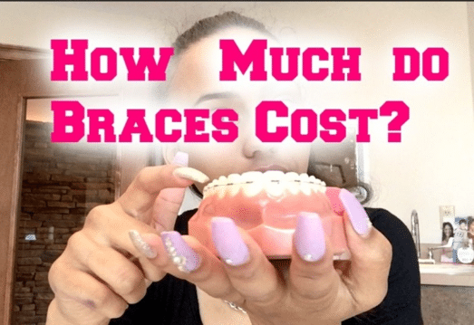 Facts About How Much Do Braces Cost A Month Uncovered
