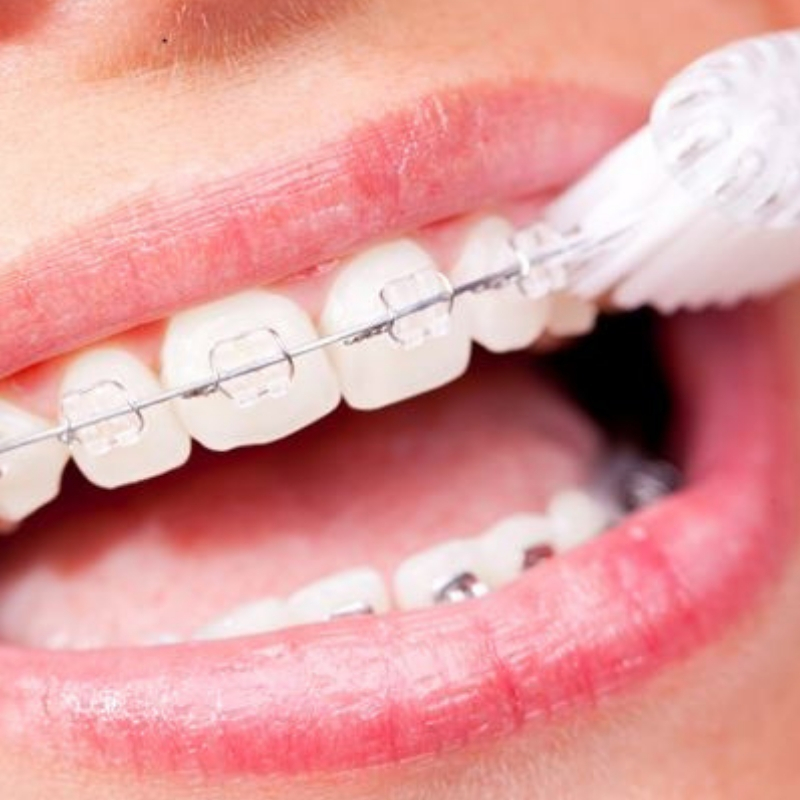 Let’s Celebrate National Orthodontics Month