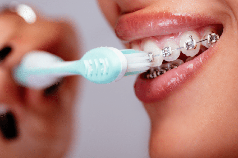 Brushing With Braces | North Durham Orthodontics